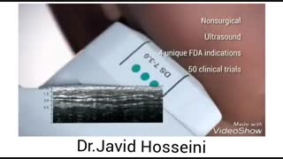 جوانسازی پوست با هایفوتراپی پیلینگ