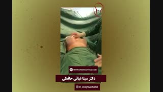 پروتز سینه در افرادی که سینه های توبروس یا بوقی شکل دارند