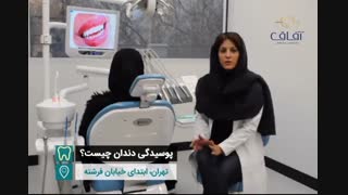 پوسیدگی دندان