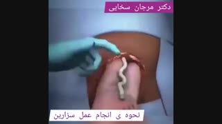 فیلم عمل سزارین