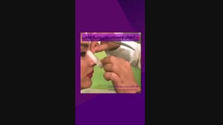 فیلم آموزش چسب زدن بینی پس از جراحی