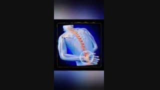 بررسی علائم و تشخیص دیسک ‌کمر و درمان به روش غیرتهاجمی